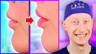 Best LIP LIFT Surgery (2022)