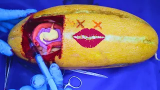 Melon Abdominal Surgery ASMR , Funny Fruit SURGERY ,🍉🪰 #ExoticHospital #fruitsurgery #Funny #asmr