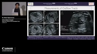 ISUOG 2022 - Dr. Trisha Vigneswaren - Systematic ultrasound approach to coarctation of aorta