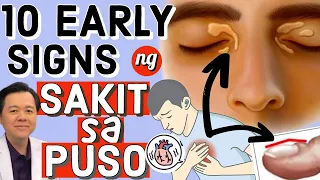 10 Early Signs ng Sakit sa Puso - Payo ni Doc Willie Ong