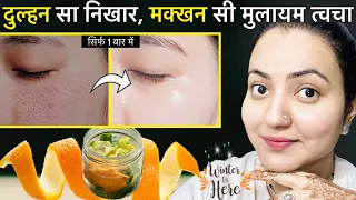 *Bridal Skin* Challenge : कितनी भी रुख़ी Dry बेजान काली त्वचा हो इस क्रीम से आएगा जबरदस्त निखार❤️