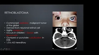 Diseases of the orbit