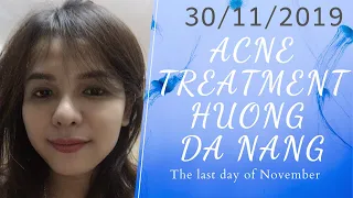 The last day of November | 30/11/2019 | Acne treatment Hương Đà Nẵng