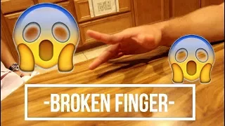 Vlog #3, Broken Finger & punched in the face!  (NO CLICKBAIT WHAT SO EVER)