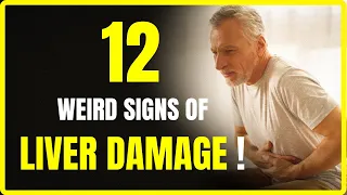 12 Weird Signs of Liver Damage | Nutrirevitalize