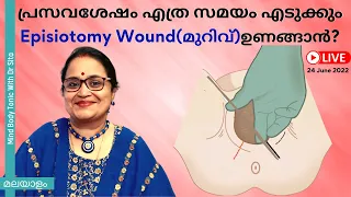 പ്രസവശേഷം എത്ര സമയം എടുക്കും Episiotomy Wound(മുറിവ്)ഉണങ്ങാൻ?I എപ്പോൾ ഡോക്ടറെ കാണിക്കണം l  Malayalam