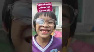 ถอนฟันสุดเกรียน อวสานอาหารเย็น