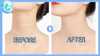 How to Get Rid of Neck Lines, Face Workout to rid of Neck Lines.