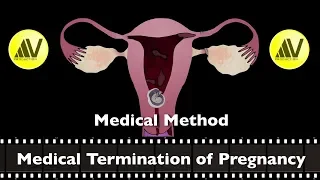 MTP Part II Medical Method