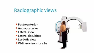 Chest 1 Prof.Dr. Mamdouh Mahfouz