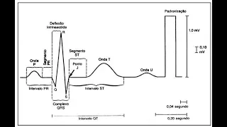 Aprenda a ler um Eletrocardiograma (ECG)