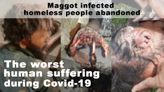 Human flesh-eating maggots infect homeless people: The worst human suffering during Covid-19