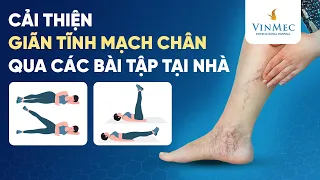 Cải thiện giãn tĩnh mạch chân qua các bài tập tại nhà | BS Lê Đức Hiệp, BV Vinmec Times City