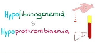 Hypofibrinogenemia and Hypoprothrombinemia