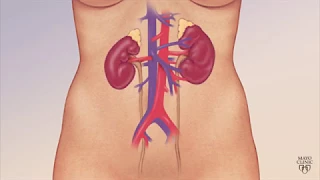 Mayo Clinic Minute: Understanding chronic kidney disease