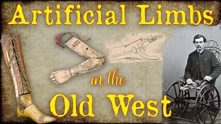 Aritificial Limbs in the Old West