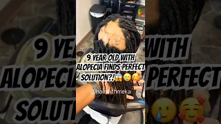 Crazy Loc Transformation!?🤯🥹😱 Girl With Alopecia Get's Miracle Treatment!