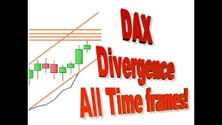 DAX Today 23 May,  Divergence everywhere!