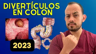 ⚠️ El 𝗠𝗲𝗷𝗼𝗿 𝗧𝗥𝗔𝗧𝗔𝗠𝗜𝗘𝗡𝗧𝗢 de la Enfermedad Diverticular (Actualizado Para pacientes)