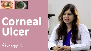 Corneal Ulcer - What causes it? What are the symptoms? What is the treatment?