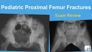 Pediatric Proximal Femur Fractures Exam Review - Lindsay Andras, MD