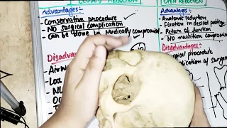 open reduction vs close reduction