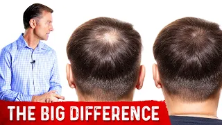 Normal Hair Loss vs. Abnormal Hair Loss