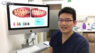 How to Floss
