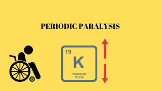 Periodic Paralysis | Hypokalemic and Hyperkalemic Periodic Paralysis | Channelopathies |