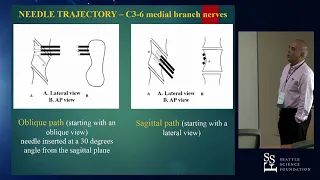 Cervical Neurotomy Techniques - Mario De Pinto, MD