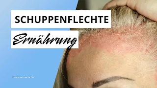 Ernährung bei Schuppenflechte: Tipps gegen Psoriasis