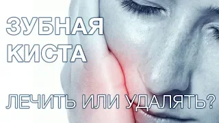 Киста зуба. Лечить или удалять кисту?