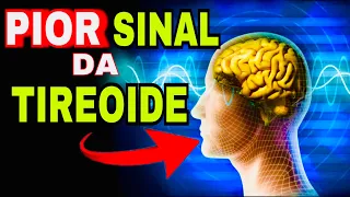 7 SINAIS PERIGOSOS do HIPERTIREOIDISMO (Sintomas da Tireoide Produzindo Muitos Hormônios T3 e T4)