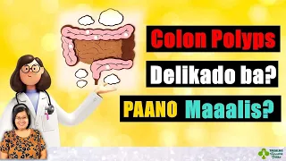 Paliwanag sa COLON POLYPS🍄 (Health Screening ~ Colonoscopy) - Tagalog Health Tips | Nurse Dianne