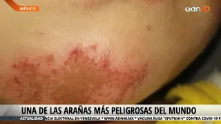 Peligro de la araña violinista