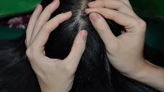 ASMR 1 Hour Scalp Scratching Fast And Aggressive, Scalp Check Real Person Relaxing For Sleep