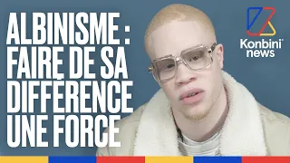 Hassan Koné - "Kalash Criminel m’a aidé à avoir plus confiance en moi" | Fier d'être albinos
