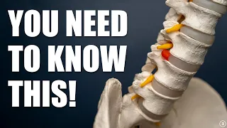 What is a Disc Herniation? Can It Heal? Do You NEED Surgery? (Myths | Education | Rehab | Exercise)