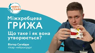 МІЖХРЕБЦЕВА ГРИЖА. ЯК УТВОРЮЄТЬСЯ. Нейрохірург Київ. Межпозвоночная грыжа. Удаление грыжи Киев