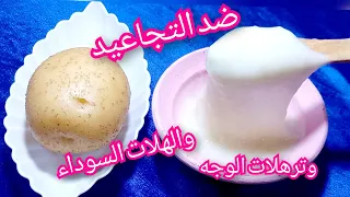 كريم البطاطاالسحري👌  ضد التجاعيد والترهلات والبقع الداكنة  نتيجة فورية بشرة صافية وناعمة كلاطفال