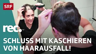 Haarausfall bei Frauen – Von Vorurteilen, Schamgefühl und Weiblichkeit | Reportage | rec. | SRF