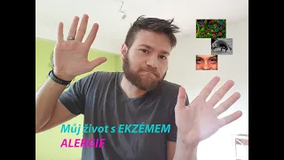 můj život s ekzémem I Alergie