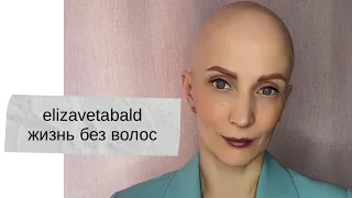 ЖИЗНЬ БЕЗ ВОЛОС #алопеция