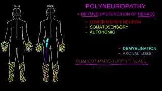 Polyneuropathy