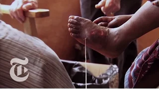 The Guinea Worm Slayer - 2013 | The New York Times