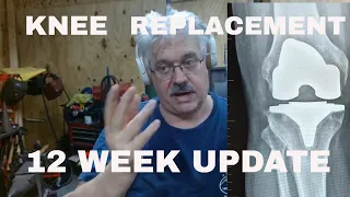 12 Week Update After Knee Replacement Surgery