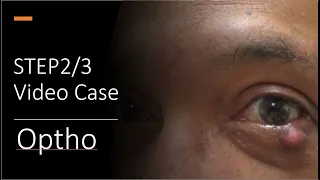 Ophthalmology STEP 2 Case + Explanation (Case 1)