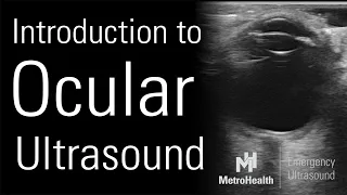 Introduction to Ocular Ultrasound