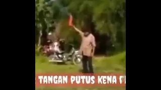 BUNTUNG NYAH TANGAN BAPA INIH KENA PETASAN DAH MENG GEGERKAN PARA WARGA😭😭😭😭