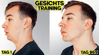 1000 Tage Mewing | Gesichtstraining Selbstexperiment